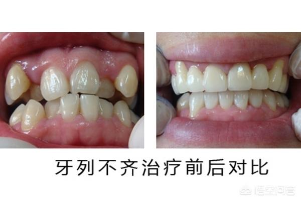 宁波最新24小时牙医在线咨询方法分析(最方便真实的宁波有没有24小时牙医方法)