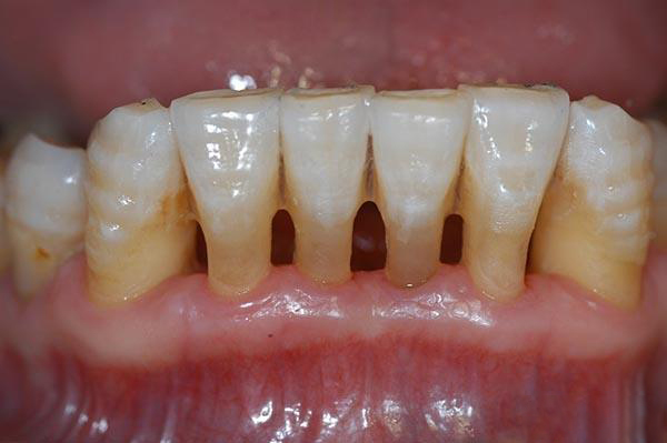 宁波最新24小时牙医在线咨询方法分析(最方便真实的宁波有没有24小时牙医方法)